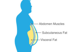 what is visceral fat?