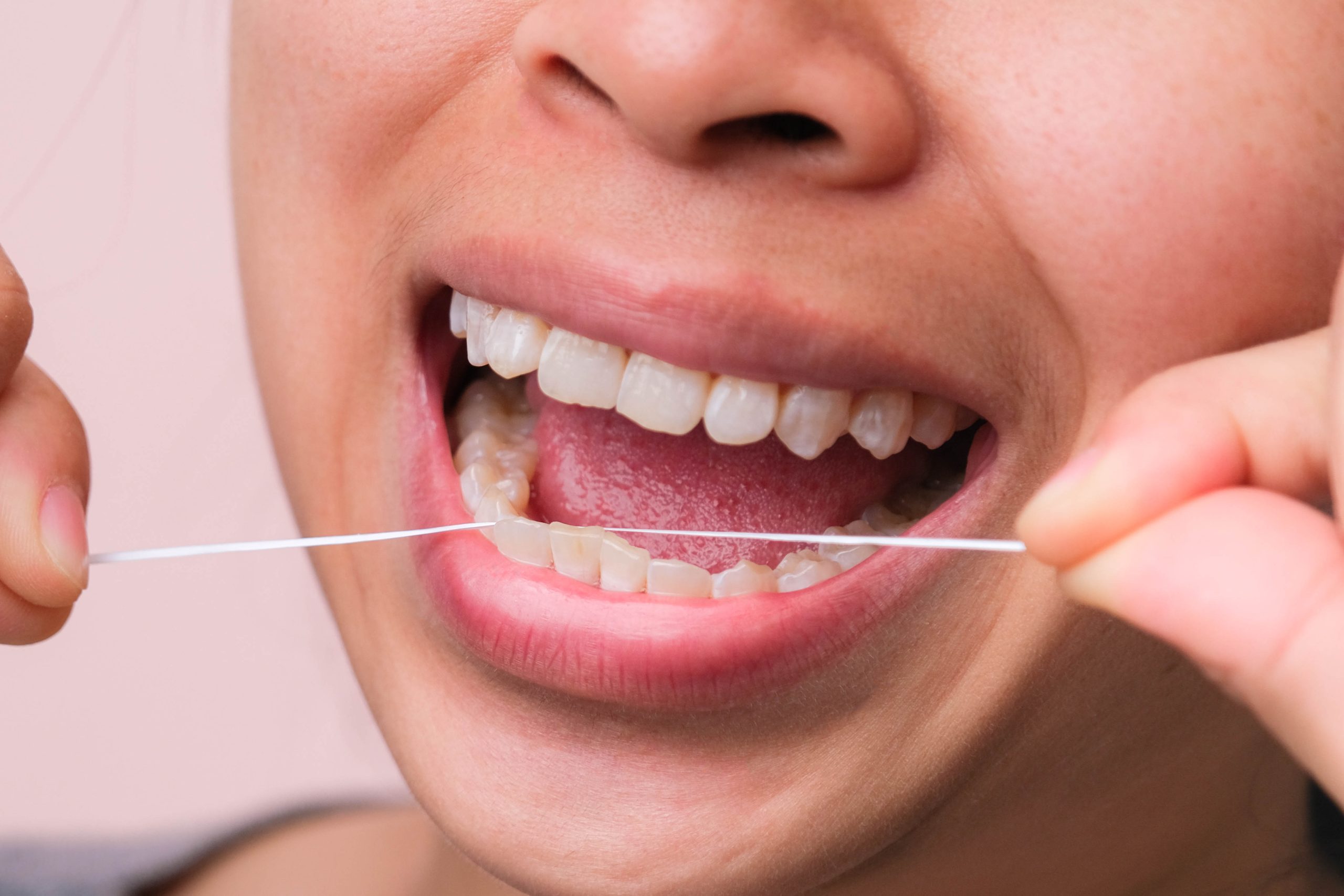 health benefits of flossing